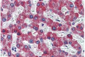 Human Liver: Formalin-Fixed, Paraffin-Embedded (FFPE) (PAR1 Antikörper  (AA 24-37))