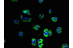 Immunofluorescent analysis of MCF-7 cells using ABIN7174993 at dilution of 1:100 and Alexa Fluor 488-congugated AffiniPure Goat Anti-Rabbit IgG(H+L) (USMG5 Antikörper  (AA 2-58))