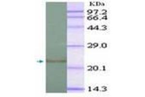 Image no. 2 for anti-Interleukin 1, beta (IL1B) (AA 118-269) antibody (ABIN791567) (IL-1 beta Antikörper  (AA 118-269))