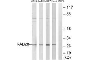 Western Blotting (WB) image for anti-RAB20, Member RAS Oncogene Family (RAB20) (AA 115-164) antibody (ABIN2890575) (RAB20 Antikörper  (AA 115-164))