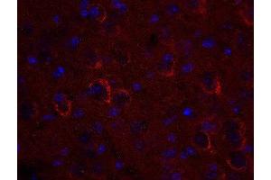 Indirect immunostaining of PFA fixed mouse brain section (dilution 1 : 500; red).
