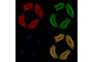 ABIN6256196 and ABIN6267433 staining Hela cells(4h of LPS treatment) by IF/ICC. (Filamin A Antikörper  (pSer2152))