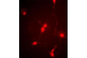 Immunofluorescence image of cultured chick retinal amacrine (neuronal) cells labeled with CLC4 Antibody (C-term). (CLCN4 Antikörper  (C-Term))