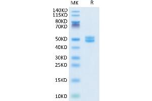 LGALS1/Galectin 1 Protein (AA 2-135) (Fc Tag)