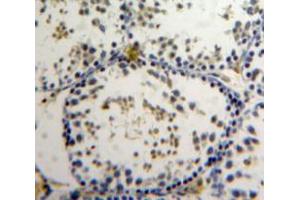 Used in DAB staining on fromalin fixed paraffin-embedded Testis tissue (ZNF384 Antikörper  (AA 307-540))