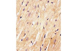 (ABIN6242465 and ABIN6577972) staining (Mouse) Med15 in Mouse heart tissue sections by Immunohistochemistry (IHC-P - paraformaldehyde-fixed, paraffin-embedded sections). (MED15 Antikörper  (C-Term))