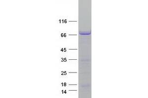 Western Blotting (WB) image for Microtubule-Associated Protein 2 (MAP2) (Transcript Variant 2) protein (Myc-DYKDDDDK Tag) (ABIN2725302)