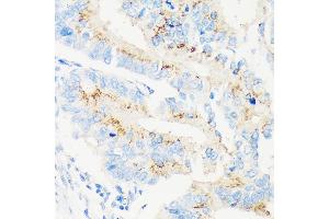 Immunohistochemistry (IHC) image for anti-Mannosidase, Alpha, Class 1A, Member 2 (MAN1A2) (AA 60-180) antibody (ABIN7268390)
