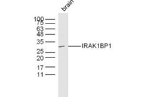 Mouse brain lysates probed with IRAK1BP1 Polyclonal Antibody, Unconjugated  at 1:300 dilution and 4˚C overnight incubation. (IRAK1BP1 Antikörper  (AA 51-150))