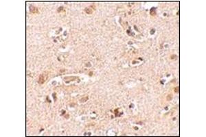 Immunohistochemistry of Nanos2 in human brain tissue cells with this product at 2. (NANOS2 Antikörper  (N-Term))