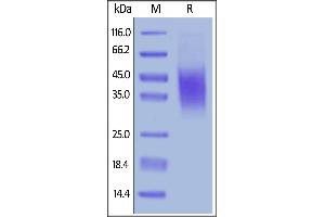 SDS-PAGE (SDS) image for CD47 (CD47) (AA 19-140) (Active) protein (His tag) (ABIN6253634)