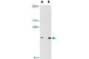 Western blot analysis of SPG11 in mouse heart tissue lysate with SPG11 polyclonal antibody  at (A) 0. (SPG11 Antikörper  (C-Term))