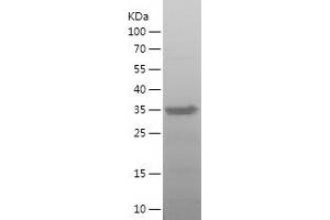 Western Blotting (WB) image for Sialophorin (SPN) (AA 27-253) protein (His tag) (ABIN7125088) (CD43 Protein (AA 27-253) (His tag))