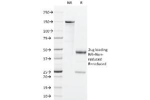 SDS-PAGE Analysis Purified GM-CSF Rat Monoclonal Antibody (BVD2-21C11). (GM-CSF Antikörper)