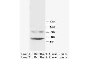 Image no. 1 for anti-Phospholamban (PLN) (N-Term) antibody (ABIN1495356) (Phospholamban Antikörper  (N-Term))