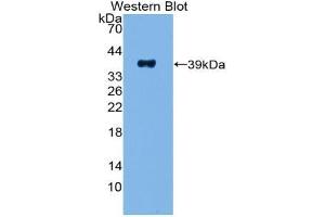 Western blot analysis of the recombinant protein. (PPY Antikörper  (AA 30-87))