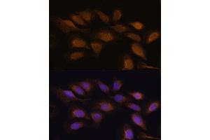 Immunofluorescence (IF) image for anti-Ribosomal Protein S6 Kinase, 90kDa, Polypeptide 2 (RPS6KA2) (AA 632-733) antibody (ABIN7270037)