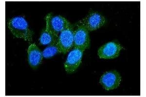 IF analysis of LCP1 using anti-LCP1 antibody (ABIN6719421). (LCP1 Antikörper)