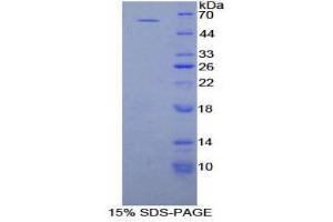 SDS-PAGE (SDS) image for Proliferating Cell Nuclear Antigen (PCNA) (AA 6-261) protein (His tag,GST tag) (ABIN2123518)