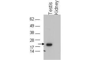 Image no. 1 for anti-Glutathione Peroxidase 4 (GPX4) (C-Term) antibody (ABIN199918) (GPX4 Antikörper  (C-Term))