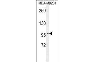 Western blot analysis in MDA-MB231 cell line lysates (35ug/lane). (ST7 Antikörper  (AA 169-197))