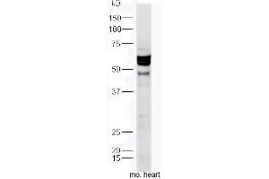 Mouse heart lysates probed with Anti-TXA2R Polyclonal Antibody, Unconjugated  at 1:300 in 4˚C. (TBXA2R Antikörper  (AA 51-150))