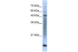 WB Suggested Anti-SMARCE1 Antibody Titration: 0. (SMARCE1 Antikörper  (N-Term))
