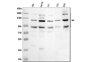 Western blot analysis of PML using anti-PML antibody (ABIN4886699).