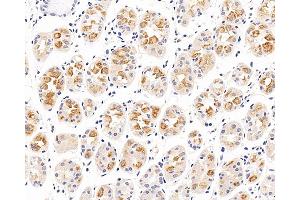 Immunohistochemistry analysis of paraffin-embedded human stomach using CXCR7 Polyclonal Antibody at dilution of 1:100.