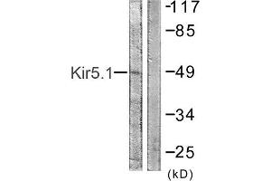 Western Blotting (WB) image for anti-Potassium Inwardly-Rectifying Channel, Subfamily J, Member 16 (KCNJ16) (Ser416) antibody (ABIN1848056)