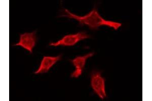 ABIN6274395 staining Hela by IF/ICC. (RBM26 Antikörper  (Internal Region))