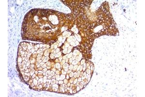 Formalin-fixed, paraffin-embedded human Skin stained with Pan-Cytokeratin Recombinant Rabbit Monoclonal Antibody (KRTH/1576R + KRTL/1577R). (Rekombinanter KRT77, KRT76 Antikörper)