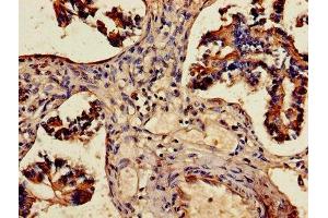 Immunohistochemistry of paraffin-embedded human lung tissue using ABIN7143677 at dilution of 1:100 (ALDH3A1 Antikörper  (AA 210-453))