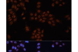 Immunofluorescence analysis of HeLa cells using GTF2I Polyclonal Antibody at dilution of 1:100.