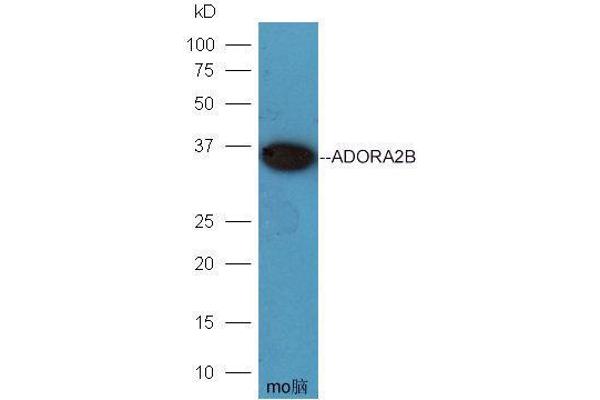 Adenosine A2b Receptor Antikörper  (AA 101-200)