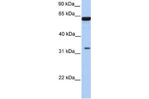 Western Blotting (WB) image for anti-Post-GPI Attachment To Proteins 3 (PGAP3) antibody (ABIN2459368) (PGAP3 Antikörper)