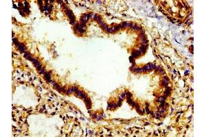Immunohistochemistry of paraffin-embedded human lung tissue using ABIN7172521 at dilution of 1: 100 (E2F4 Antikörper  (AA 160-299))