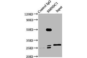 Immunoprecipitating SMNDC1 in Hela whole cell lysate Lane 1: Rabbit control IgG (1 μg) instead of ABIN7171028 in Hela whole cell lysate. (SMNDC1 Antikörper  (AA 1-238))