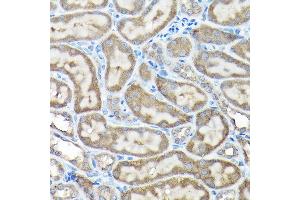 Immunohistochemistry of paraffin-embedded rat testis using NLRP1 Rabbit pAb (ABIN7268935) at dilution of 1:100 (40x lens). (NLRP1 Antikörper  (AA 1000-1100))