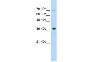 Human HepG2; WB Suggested Anti-ZRANB2 Antibody Titration: 0. (ZNF265 Antikörper  (Isoform 2, Middle Region))