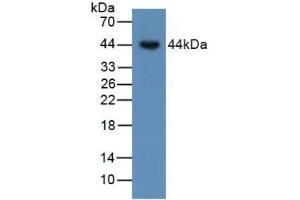 Detection of BMP15 in Human SKOV3 Cells using Polyclonal Antibody to Bone Morphogenetic Protein 15 (BMP15) (BMP15 Antikörper  (AA 266-388))