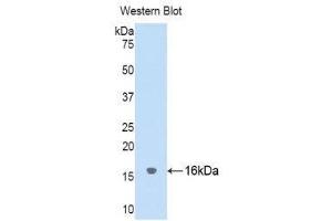 Western Blotting (WB) image for anti-Cystatin SA (CST2) (AA 21-141) antibody (ABIN1176748) (CST2 Antikörper  (AA 21-141))