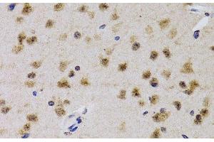 Immunohistochemistry of paraffin-embedded Mouse brain using CDK7 Polyclonal Antibody at dilution of 1:200 (40x lens). (CDK7 Antikörper)