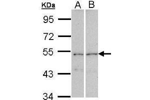 WB Image Sample (30 ug of whole cell lysate) A: A431 , B: Raji 7.