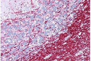Anti-PLP1 antibody IHC staining of human brain, cerebellum. (PLP1 Antikörper  (AA 36-85))