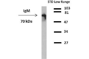 Western blot analysis of detection (reducing conditions) of IgM in human plasma using anti-human IgM peroxidase conjugate. (Maus anti-Human IgM Antikörper)