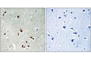 Immunohistochemistry analysis of paraffin-embedded human brain tissue, using HDAC5 (Ab-259) Antibody. (HDAC5 Antikörper  (AA 225-274))