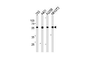 Lane 1: 293 Cell lysates, Lane 2: A431 Cell lysates, Lane 3: A2058 Cell lysates, Lane 4: NIH/3T3 Cell lysates, probed with TPIPb (978CT6. (TPTE2 Antikörper)