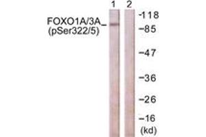 Western blot analysis of extracts from NIH-3T3 cells treated with Wortmannin 40nM 24h, using FOXO1A/3A (Phospho-Ser322+Ser325) Antibody. (FOXO1A/3A (AA 291-340), (pSer322) Antikörper)