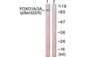anti-FOXO1A/3A (AA 291-340), (pSer322) antibody